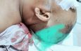Masyarakat Lae Balno Kecewa Berat, Minta Kapolres Tapteng Turun Tangan Usut Tuntas Pengeroyokan Kepala Kampung dan Tokoh Pemuda
